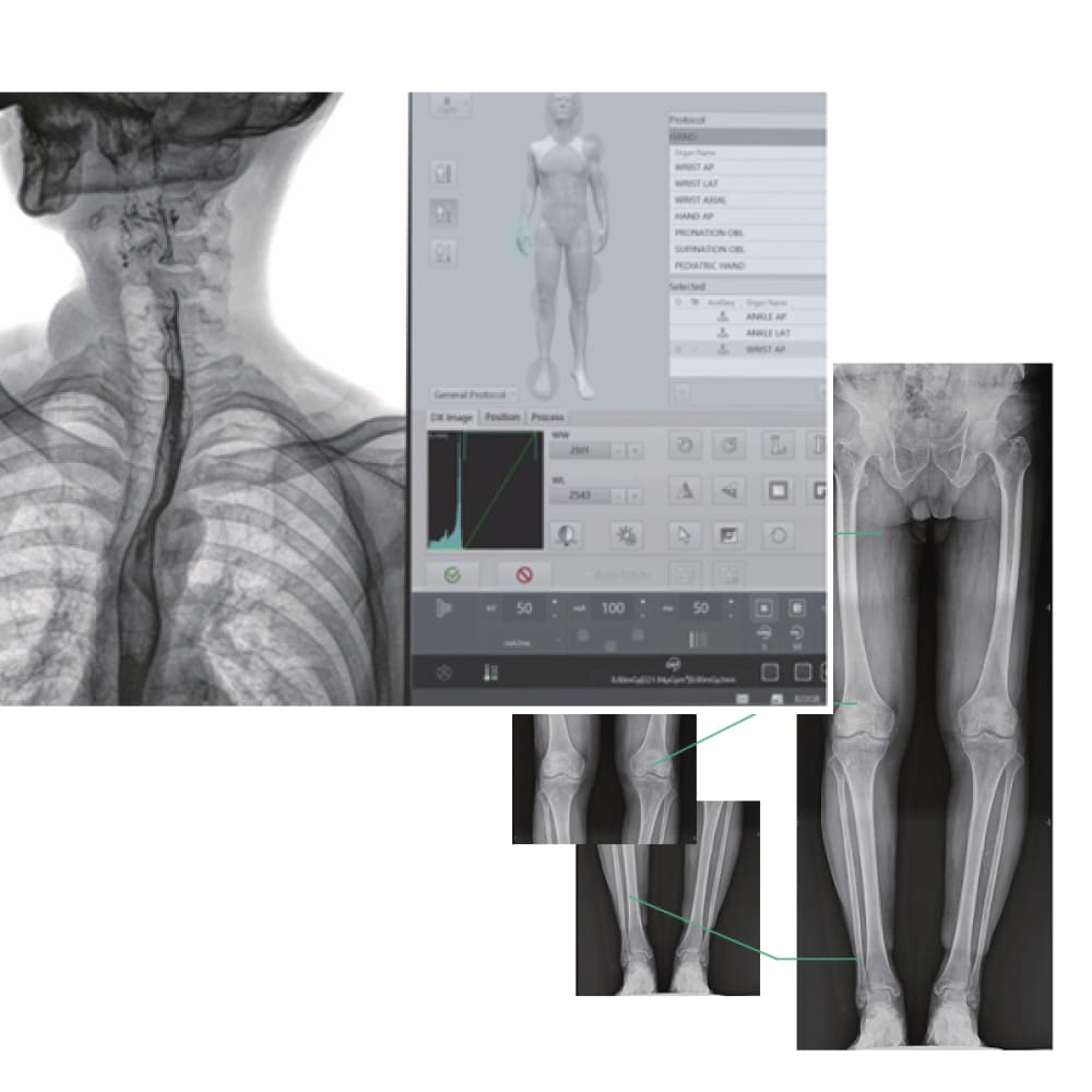 medical equipment Botswana